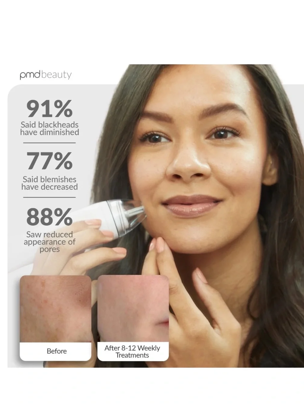 NEW PMD Advanced Exfoliation Device Personal Microderm Pro in white